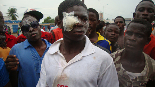 La brutalidad y detenciones policiales están presentes en Togo 